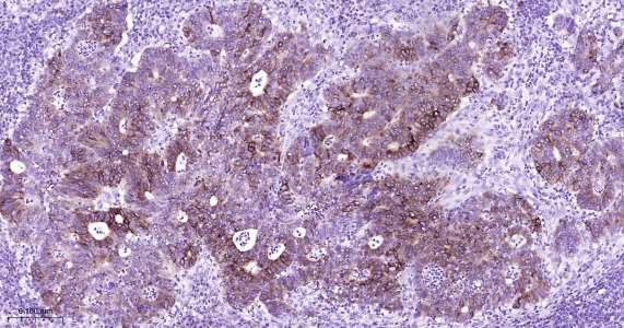 人环氧合酶2即用型免疫组化试剂盒-IHC0408H